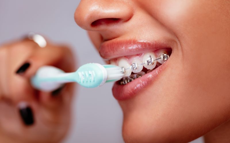 braces in chantilly va