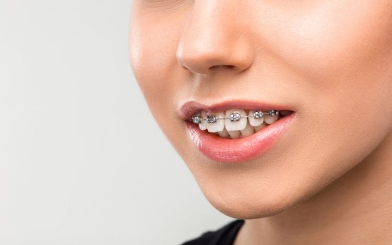 northern virginia orthodontist