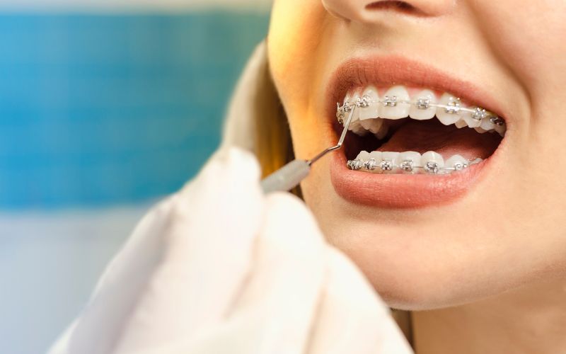 gainesville orthodontic treatment