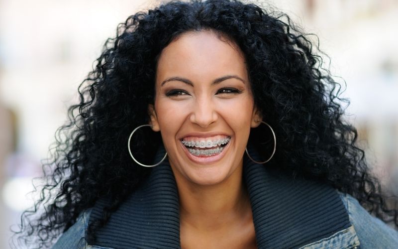 adult teeth straightening in fairfax