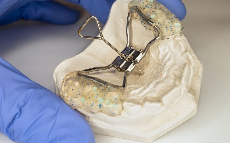 dental expander in west springfield va