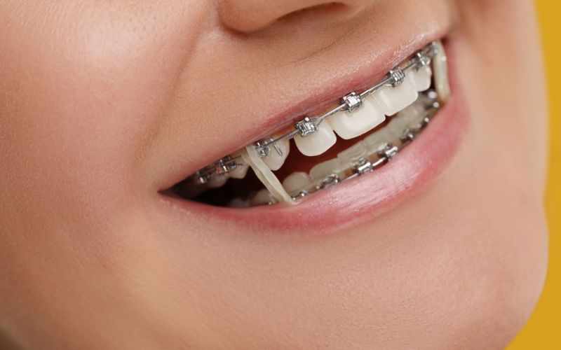 kids orthodontist herndon va