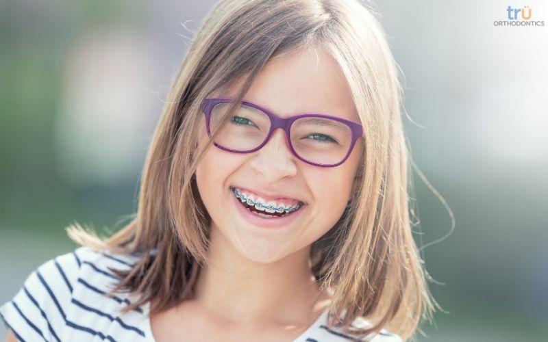 pediatric orthodontist in northern virginia