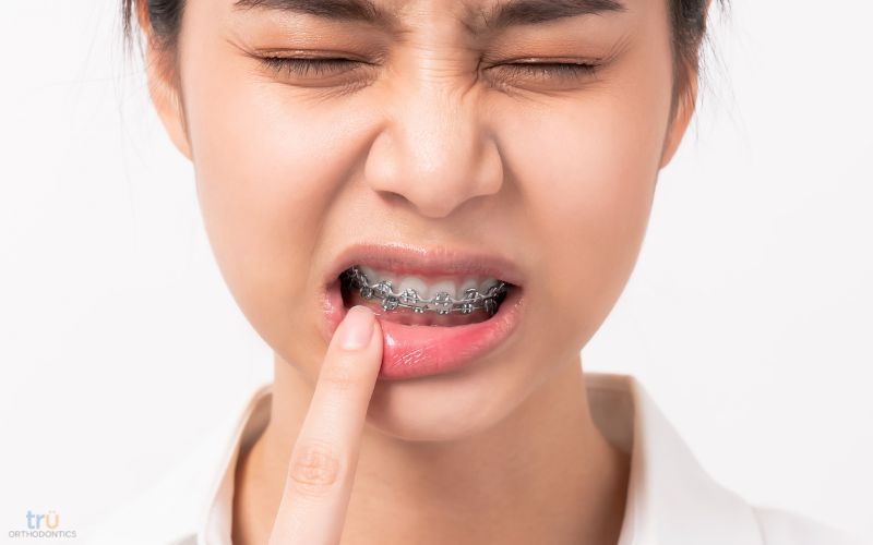 emergency orthodontic care herndon va