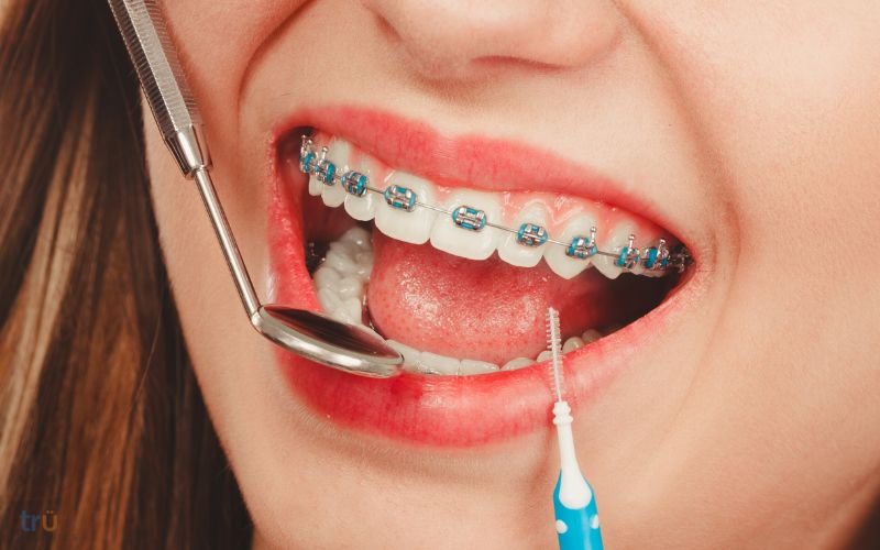 family orthodontics herndon va