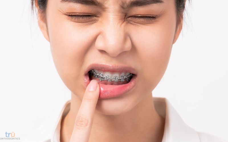 tips for pain from an orthodontist in great falls va