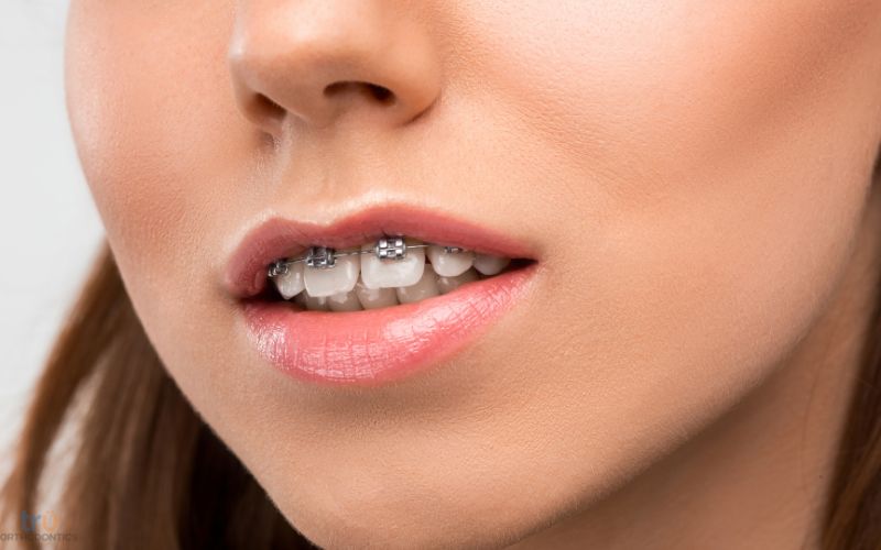 orthodontist in vienna va