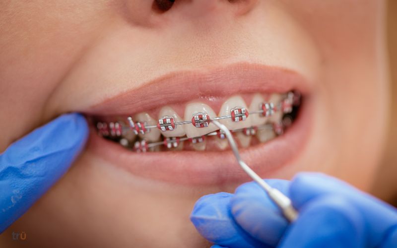 Orthodontic Specialist in Herndon VA