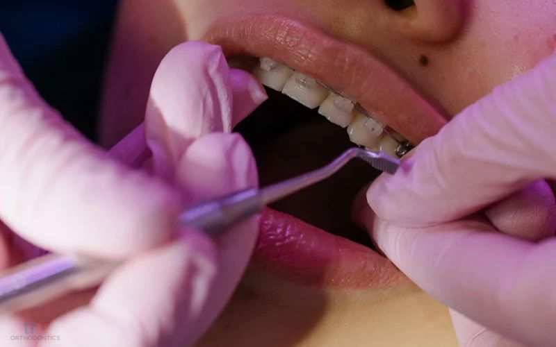 orthodontic retreatment fairfax va